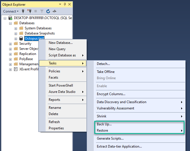 The backup and restore options in SQL Server Management Studio